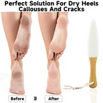 TopikaHome - Foot Pumice Stone with Handle, Double-Sided Scrub for Calluses