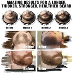 Topika 16 Piece Beard Grooming Kit for Men - Complete Beard Care Set